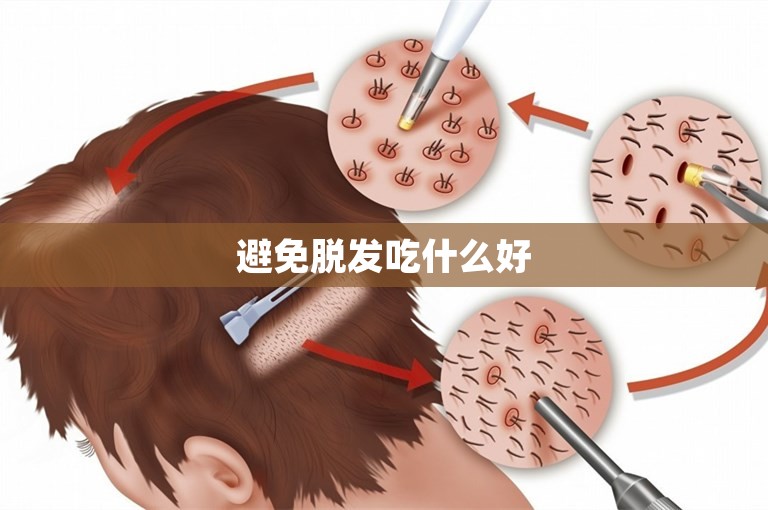 避免脱发吃什么好