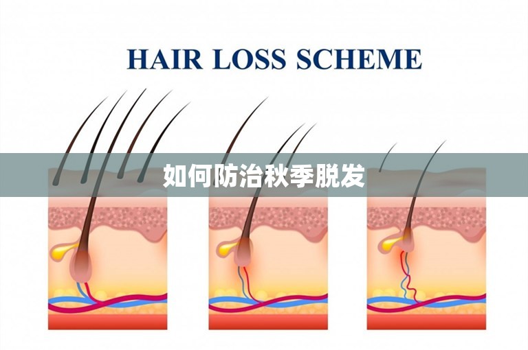 如何防治秋季脱发