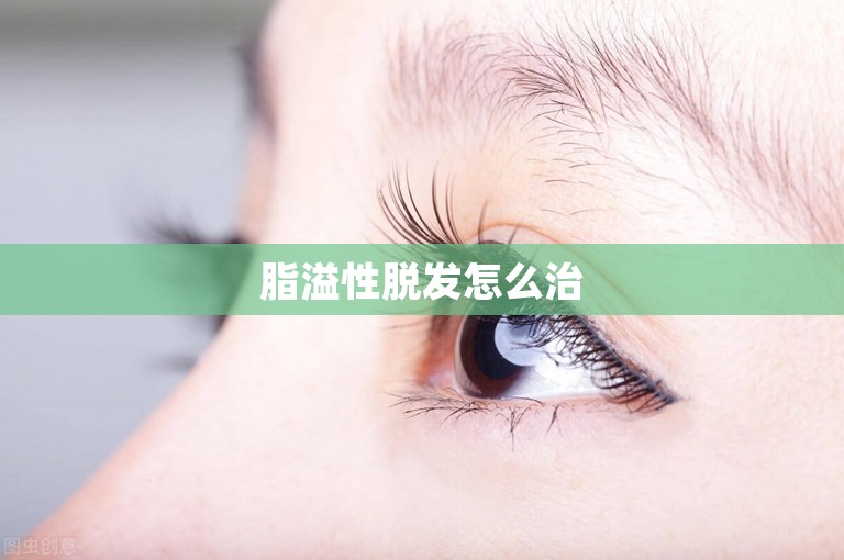 脂溢性脱发怎么治