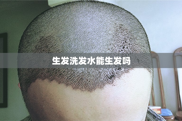 生发洗发水能生发吗