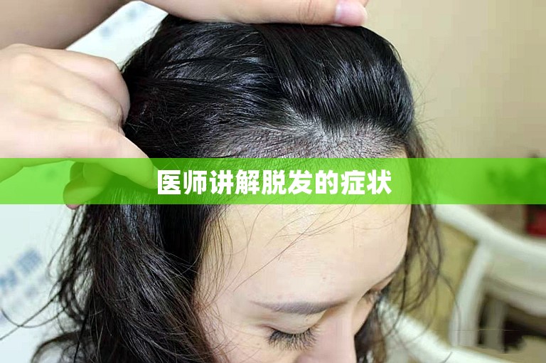 医师讲解脱发的症状