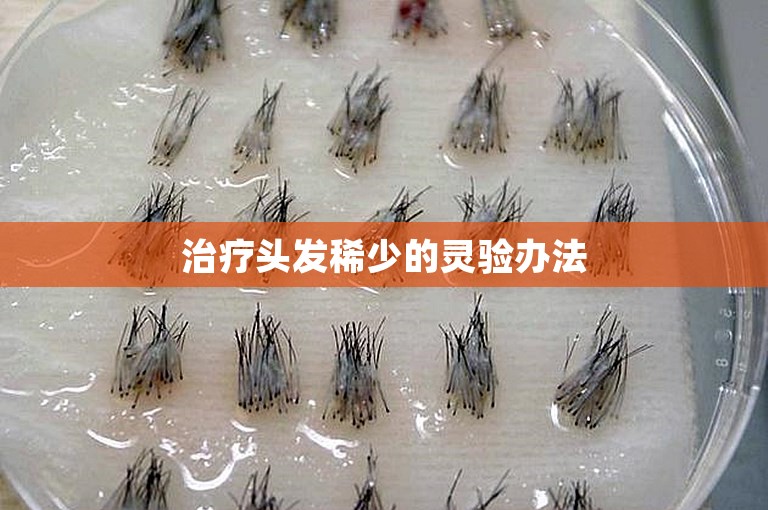 治疗头发稀少的灵验办法