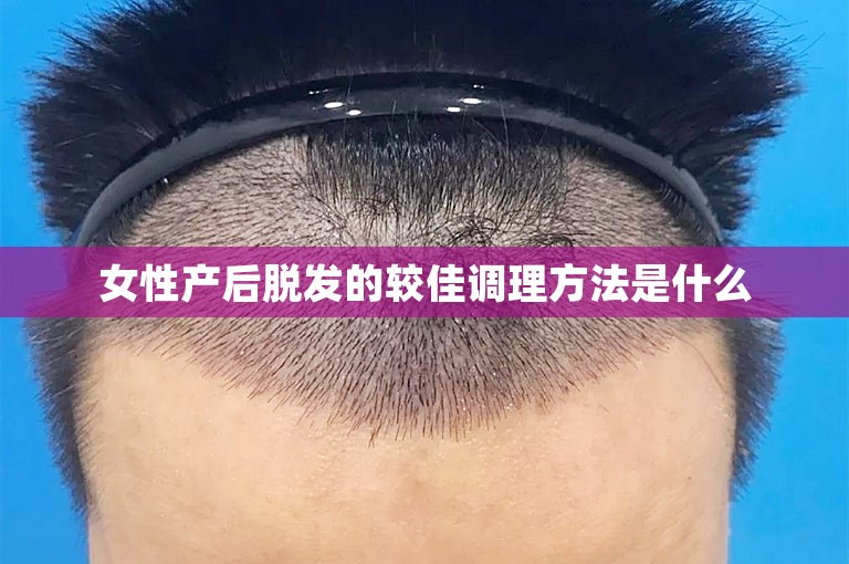 女性产后脱发的较佳调理方法是什么