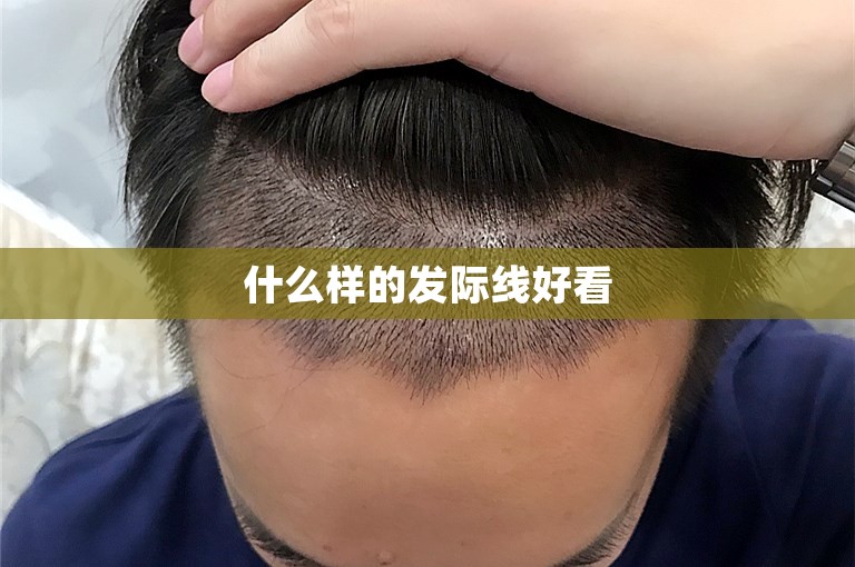 什么样的发际线好看
