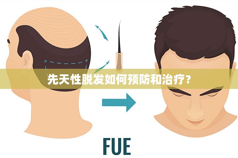 先天性脱发如何预防和治疗？
