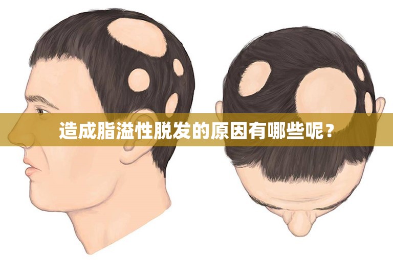 造成脂溢性脱发的原因有哪些呢？