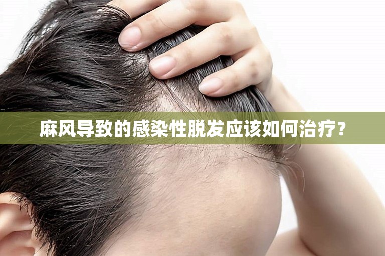 麻风导致的感染性脱发应该如何治疗? 麻风导致的感染性脱发应该如何治疗?