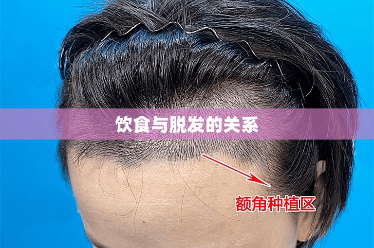 饮食与脱发的关系