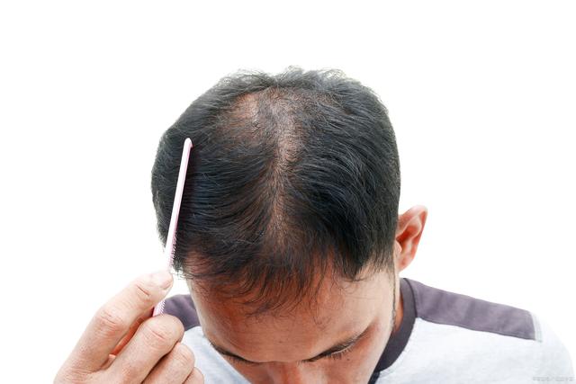 脱发用什么洗发水好呢？要知道这些才能治理脱发问题