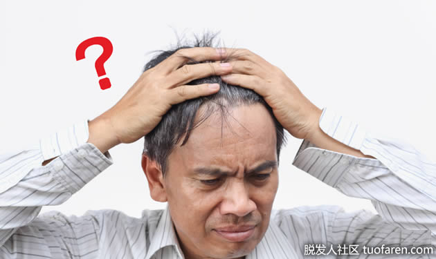 为什么头顶稀疏脱发？脱发原因出在雄激素! ？