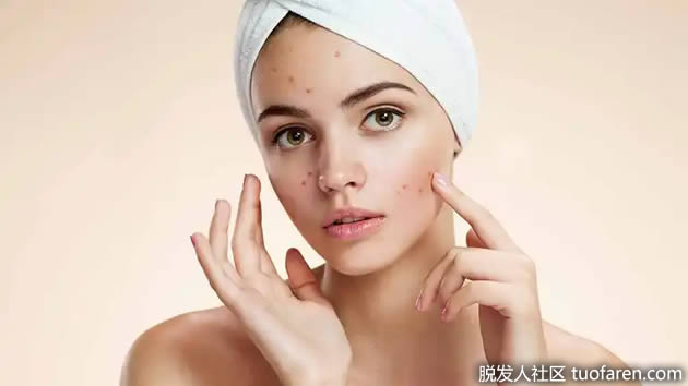 如何用苹果醋改善你的皮肤和头发