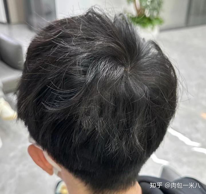 有哪些很冷门的国货洗发水/育发液，但在皮肤科医生眼中却是逆天的好用？