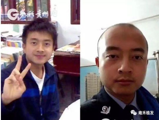 90后警察脱发成网红秃头容易出名？