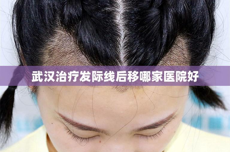 武汉治疗发际线后移哪家医院好