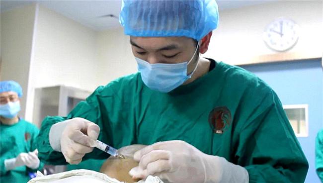 怎么判断植发效果好不好