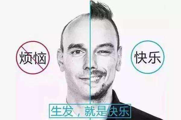什么样的人群不适合植发