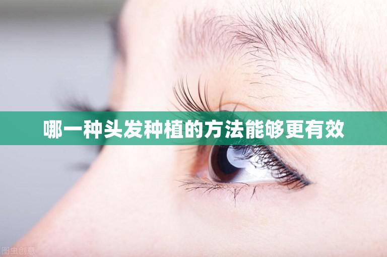 哪一种头发种植的方法能够更有效