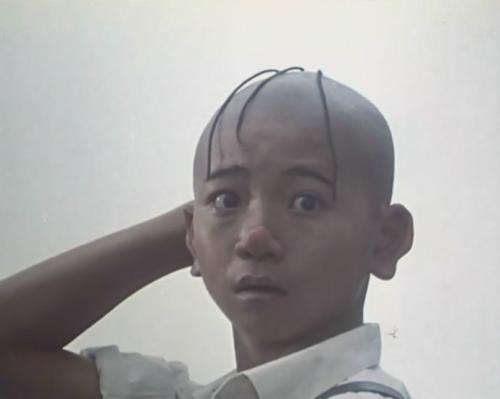 不适合进行植发手术的人群有哪些？