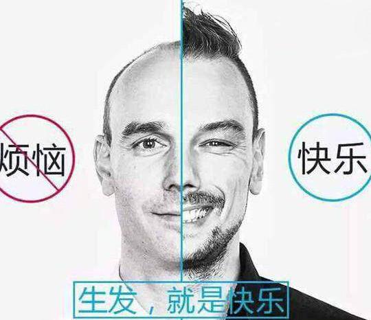 植发会伤害身体吗