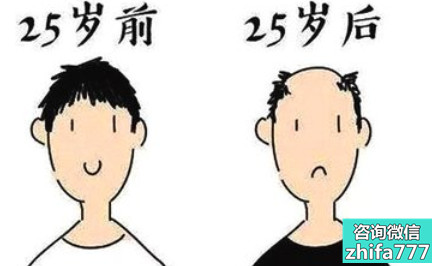 青少年脱发怎么了