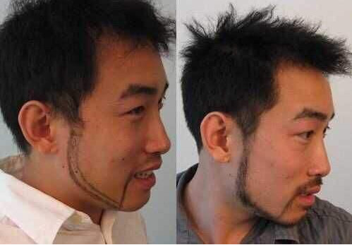 深圳胡须种植的价格贵不贵呢