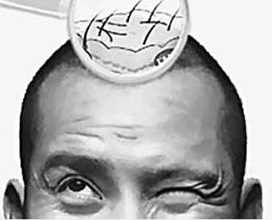 哪里可以做胡须植发