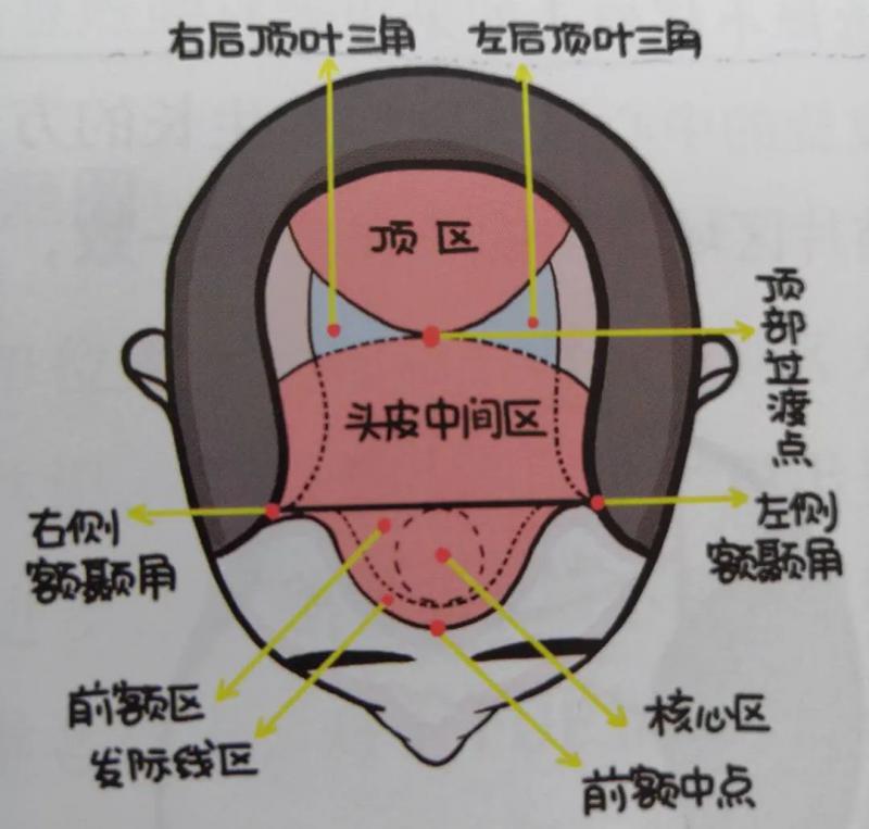脱发面积特别大不能植发？大面积脱发也能植