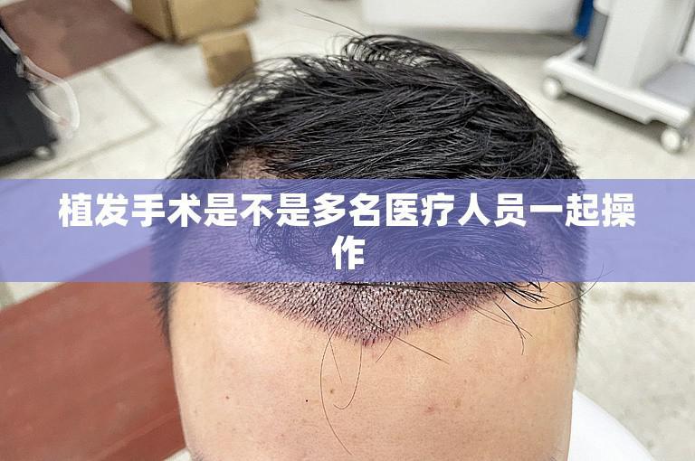 植发手术是不是多名医疗人员一起操作
