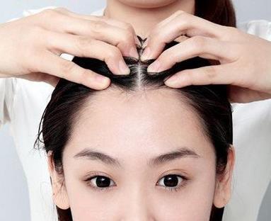 女性植发后应该注意什么？女性植发注意事项有哪些？