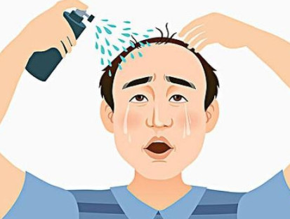 脱发了该怎么办
