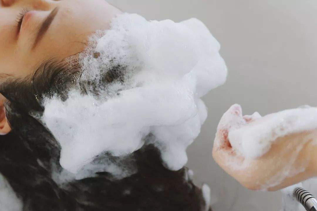 防脂溢性脱发的方法