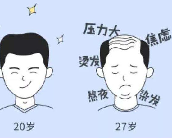 治疗脱发的方法有哪些