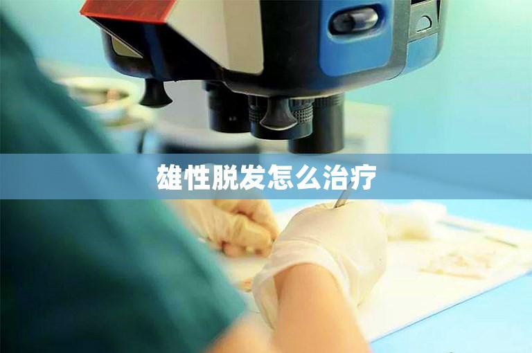 雄性脱发怎么治疗