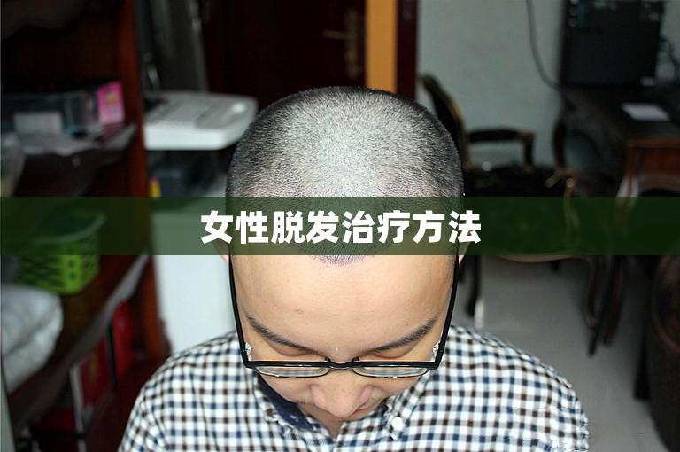 女性脱发治疗方法