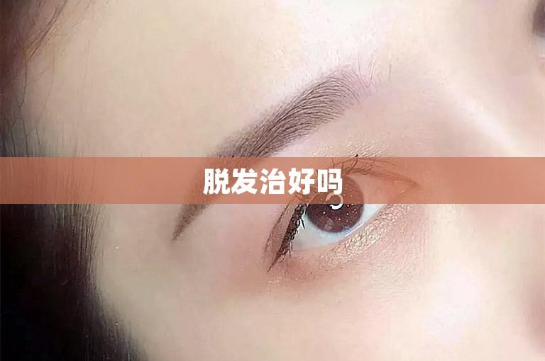 脱发治好吗