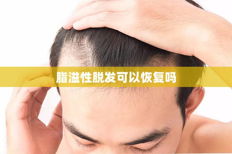 脂溢性脱发可以恢复吗