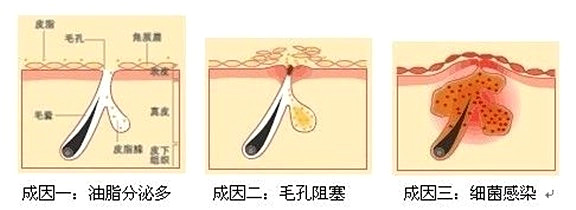为什么别人掉发还能长你却不长