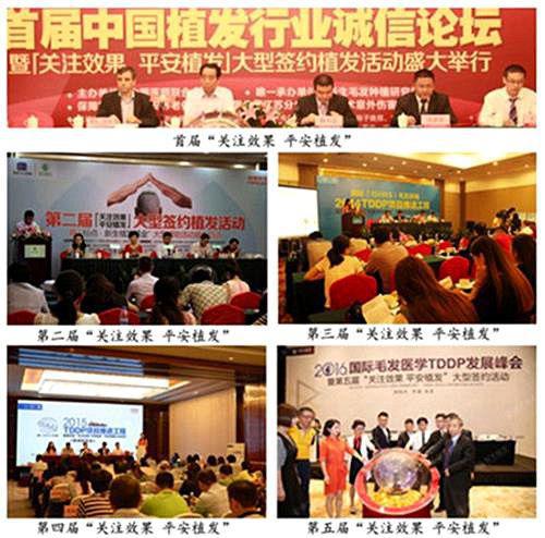 秃发的现在有什么方式可以治