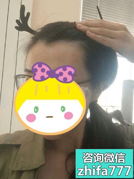 成都艾米丽美人尖种植好好看