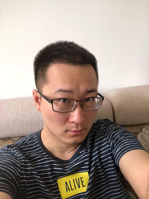 我真的快要绝望了植发吧