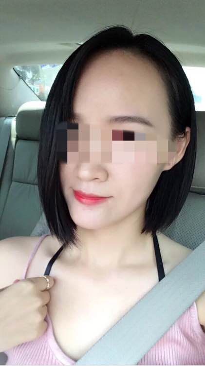 我的勇气是你给的植发吧