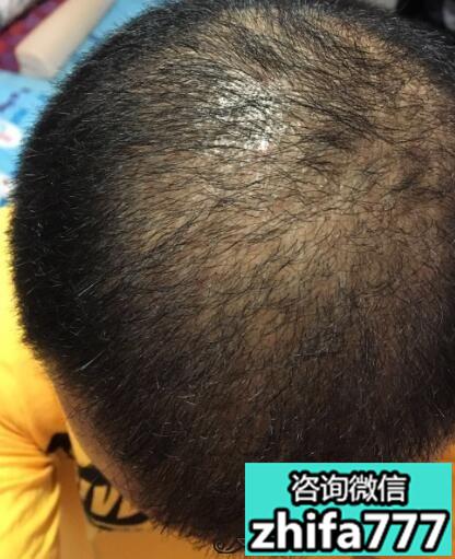 想要改变就得付出行动了