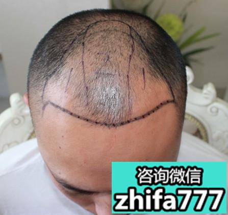 我一直希望能留个没有刘海的发型