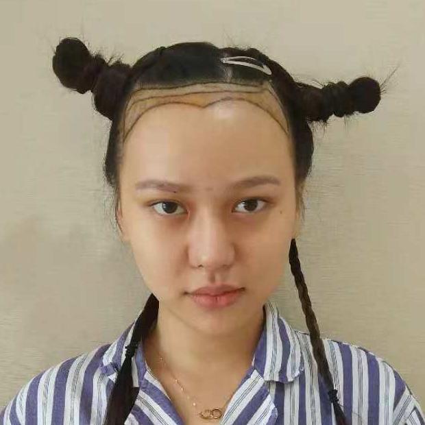 发量稀少星人的春天