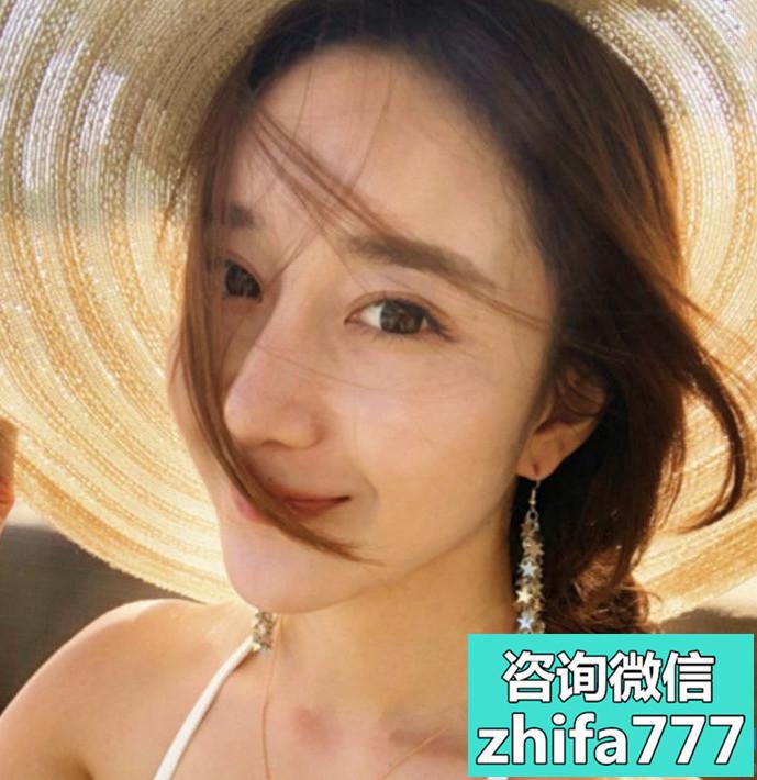 合肥崔劲松发际线种植，五官比例完美了很多
