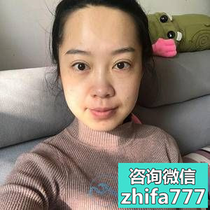 南京新生植发，前后变化是不是很大呀