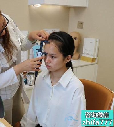 辽宁东方医院发际线种植术后很自然
