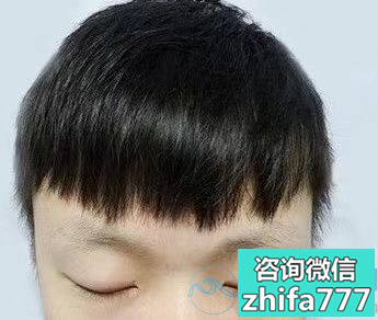 包头华美眉毛种植眉形很喜欢