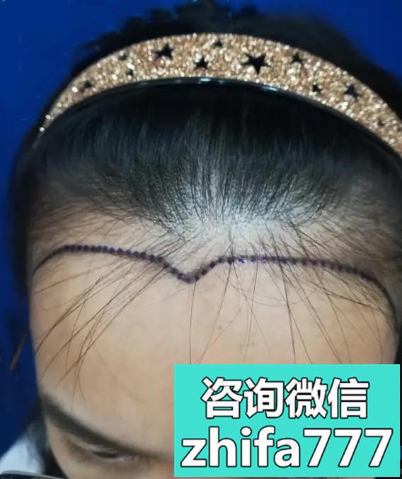 海南华美美人尖种植效果特别满意