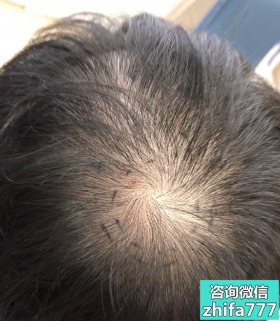 哈尔滨雅美稀少加密种植案例分享